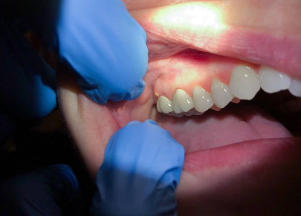 Best Tooth Pain Emergency Relief  in Lindenwold, NJ