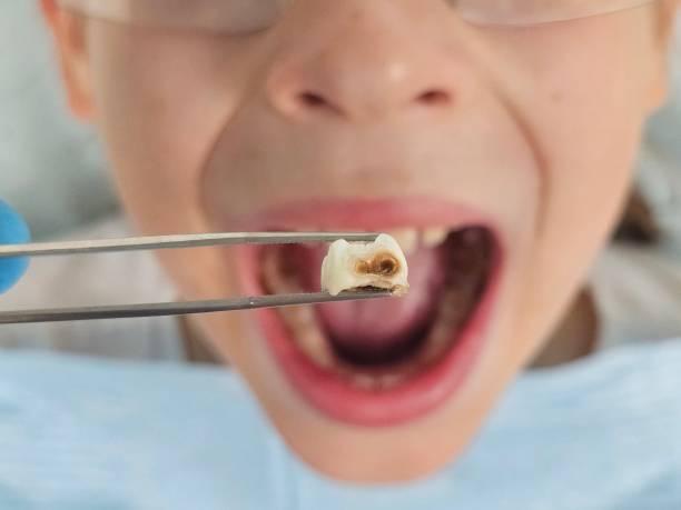 Best Cracked Tooth Emergency Dentist  in Lindenwold, NJ